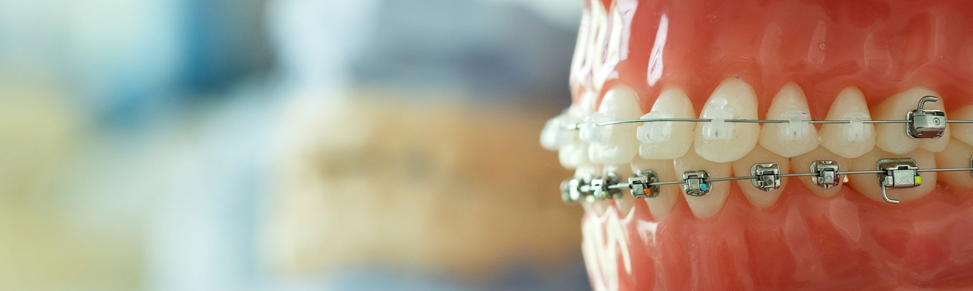 Orthodontics Near Me Northridge CA