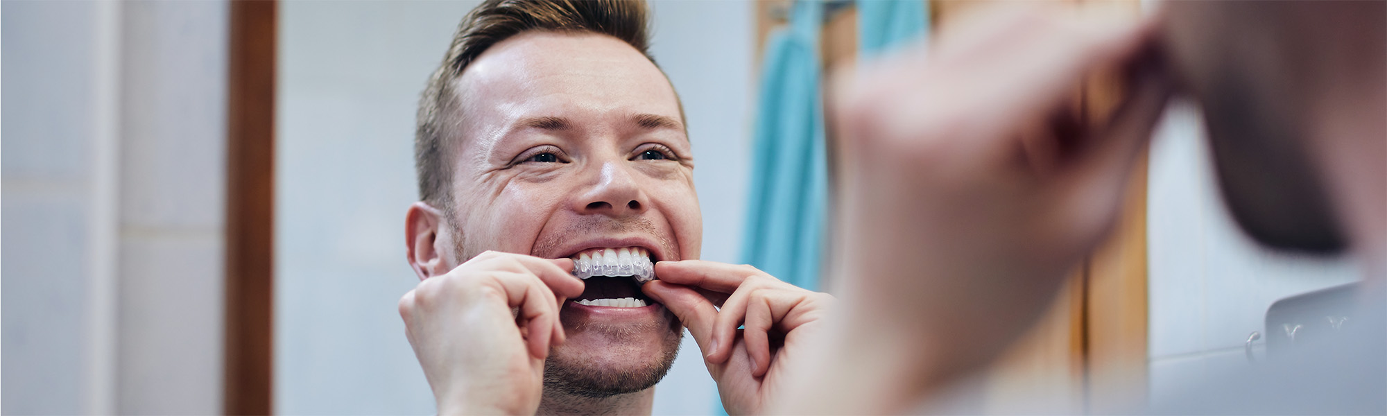 Why Is It Essential to Wear a Retainer After Orthodontic Treatment at Orthodontist of Northride CA